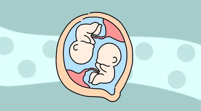 爱之晶：试管婴儿怀龙凤胎的几率高吗？