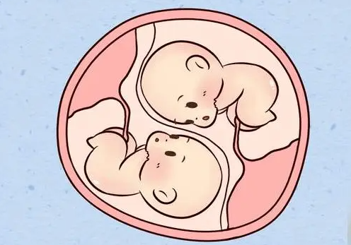 试管婴儿怀双胞胎的几率大吗？